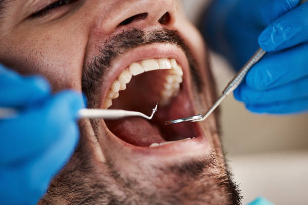  Milton, WV Emergency Dentist Pros